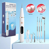 Ultrasonic Dental Scaler Electric Oral Teeth Tartar Remover Calculus Plaque Stains Cleaner Removal